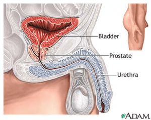 iperplasiaprostaticandrologiapuglia001