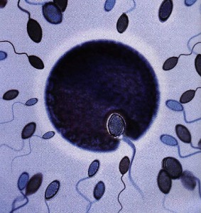 spermatozoi